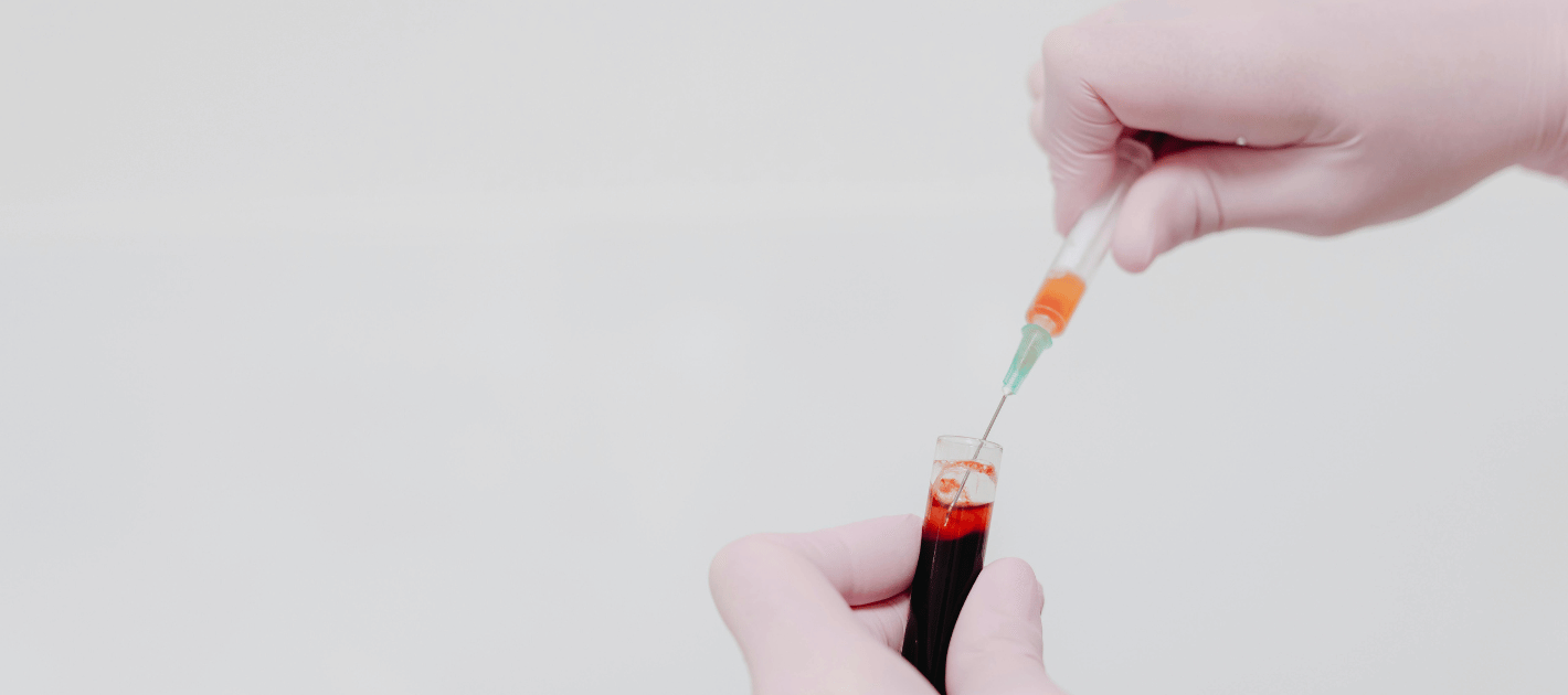 Therapeutic Phlebotomy